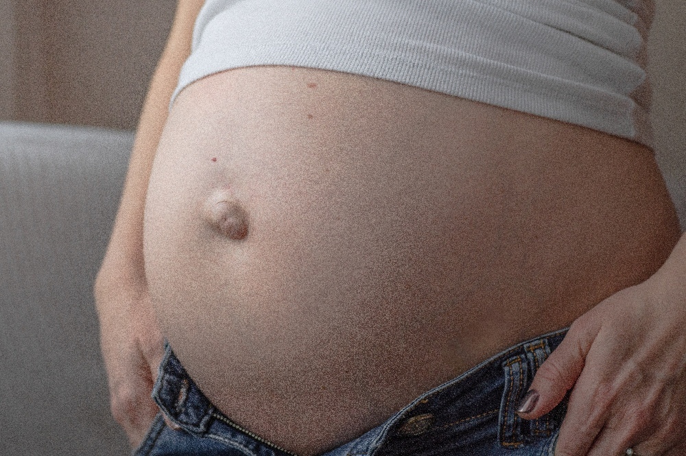 Umbilical Hernia: Causes, Seriousness and Symptoms and Solution